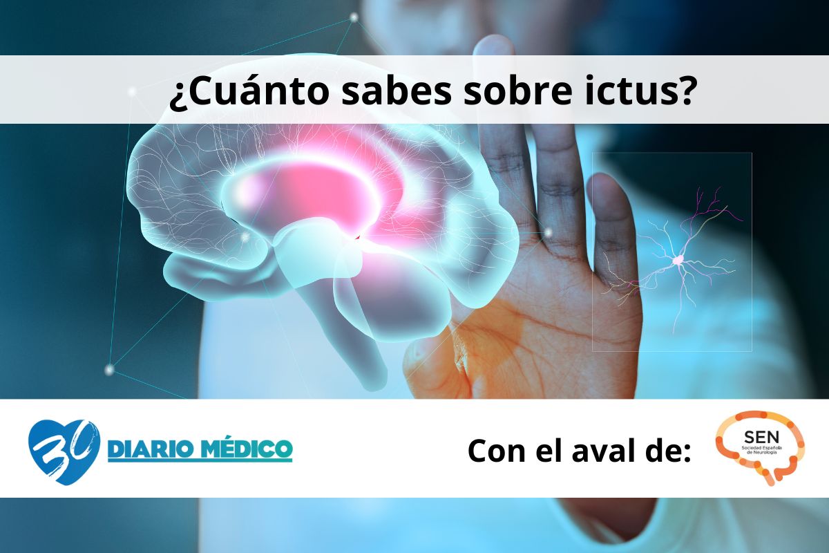 ¿Cuánto sabes sobre el ictus?