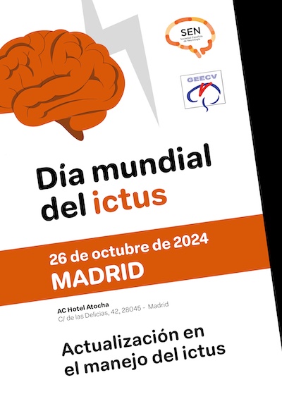 Día Mundial del Ictus. Jornada Actualización en el manejo del ictus