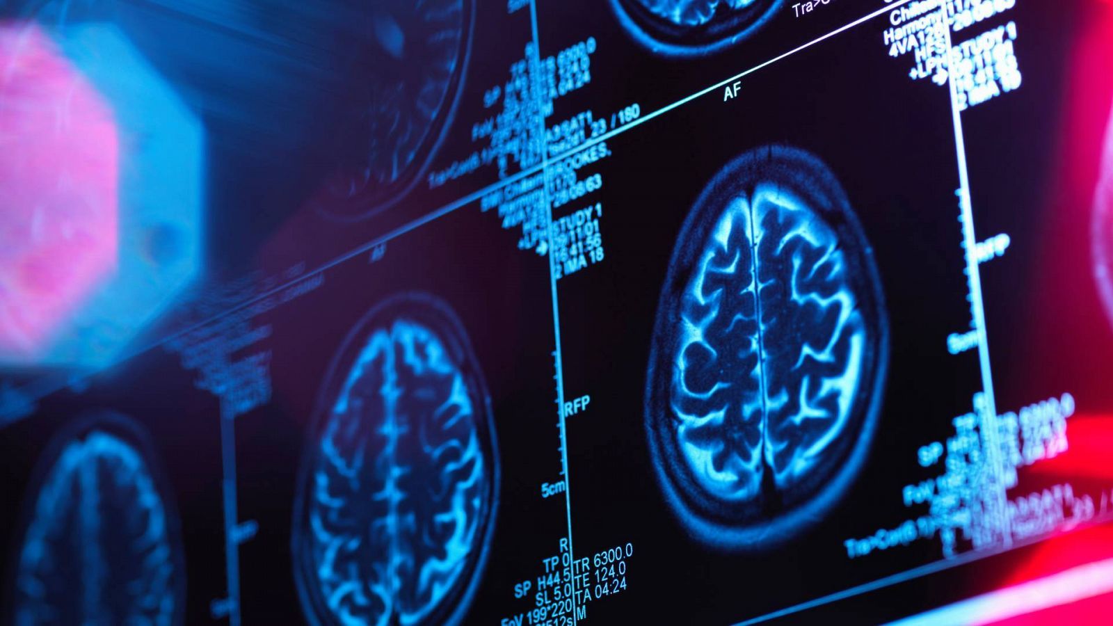RTVE y la SEN se unen para luchar contra las enfermedades neurológicas y para fomentar la salud cerebral